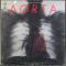 Aorta
